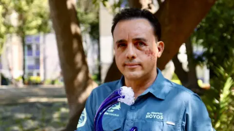 'This Animal Spared My Life': Biologist Bitten by Shark Plans to Meet It Again