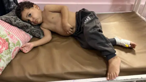 Urgent Need for Medical Evacuations in Gaza: Children Suffer Consequences of Conflict