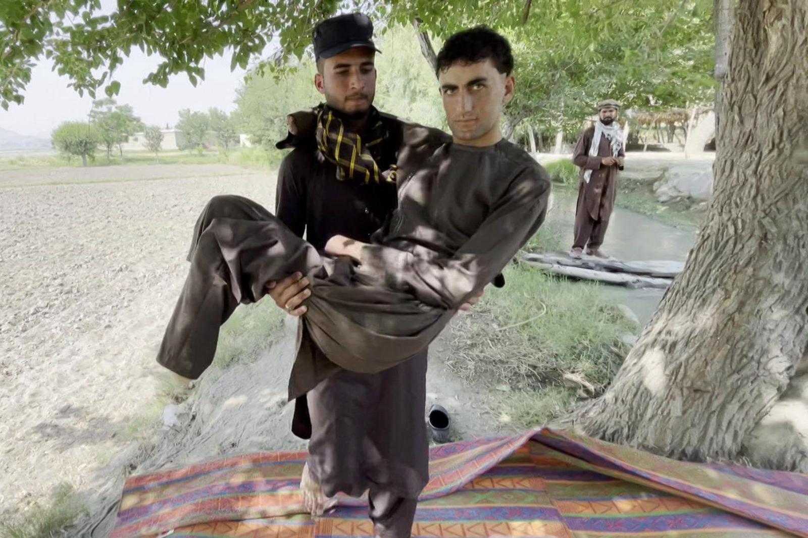 Afghan Migrants Report Brutal Beating in Turkey, Frostbite Turns Into Amputations