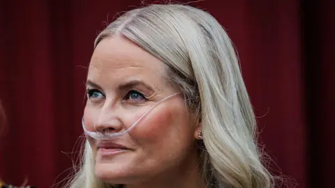 Norway’s Crown Princess Mette‑Marit Successfully Undergoes Lung Transplant